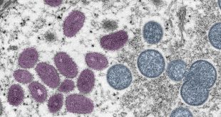 UN health body invites public to suggest new name for monkeypox