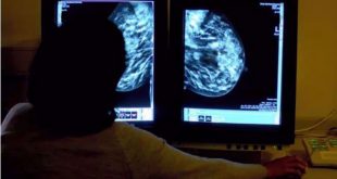 Poorer women in UK have sixth-highest cancer death rates in Europe: WHO